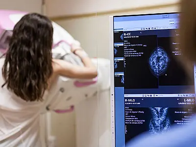 Outubro Rosa: entenda quando mulheres devem fazer mamografia pelo SUS