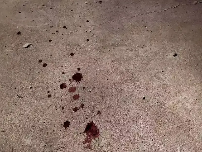 Criança é atingida de raspão por tiro durante atentado contra jovem em Dourados