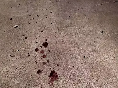 Criança é atingida de raspão por tiro durante atentado contra jovem em Dourados