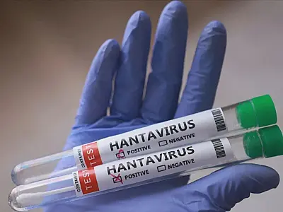 Morre em Minas Gerais possível primeira vítima fatal de hantavírus no Brasil