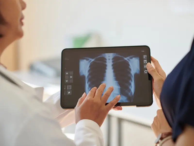 Anvisa aprova remédio inédito para doença pulmonar grave no Brasil