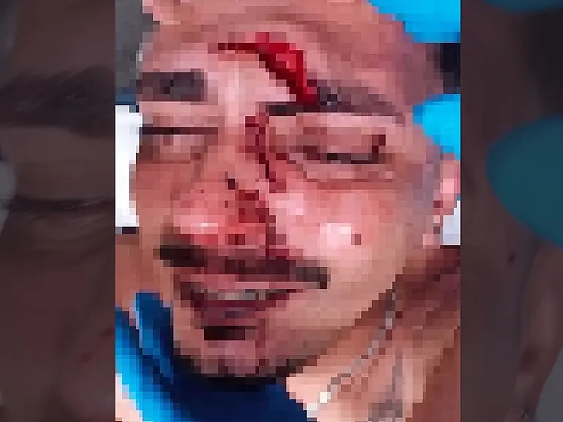 Jovem leva garrafada na cabeça durante evento em Nova Andradina