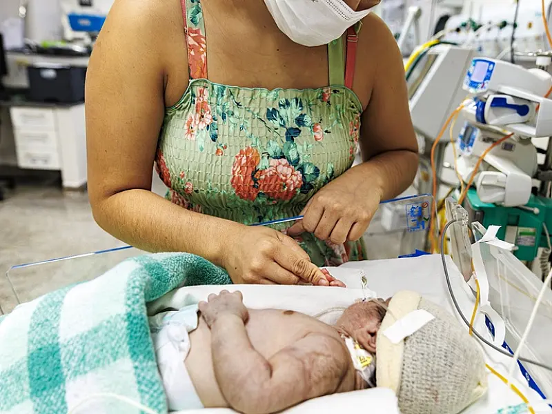 HU-UFGD integra projeto nacional para ampliar cuidado com bebês prematuros