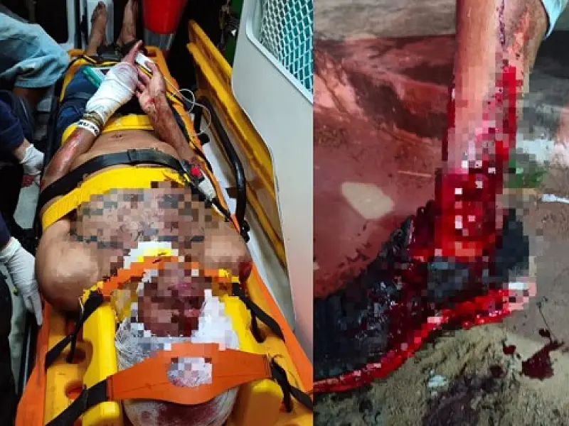 Acidente de moto termina com dois jovens gravemente feridos em Aquidauana
