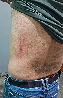 Servidor de saúde é ferido por pitbull ao visitar casa em Ribas do Rio Pardo