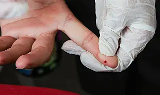 Brasil participa de pesquisa inédita que busca a cura da hepatite B